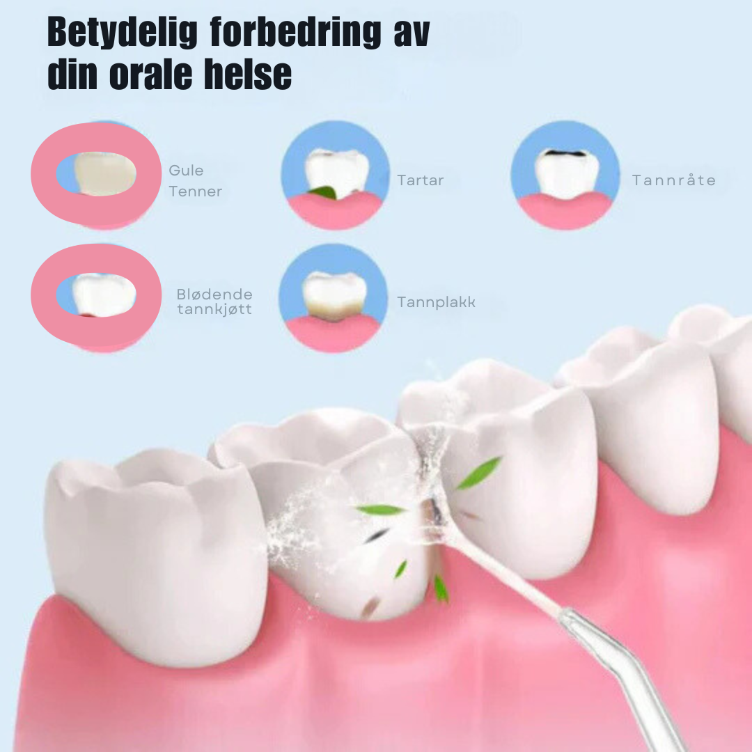 OralClean™ | Oppretthold din munnhygiene